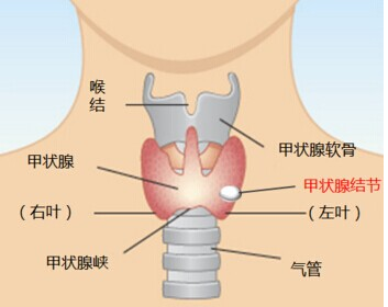 健康科普：甲状腺结节偏爱的3种人群